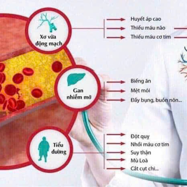 Tinh Dầu Thông Đỏ Kwangdong Chính Hãng: Giải Pháp Giảm Mỡ Máu, Ổn Định Huyết Áp