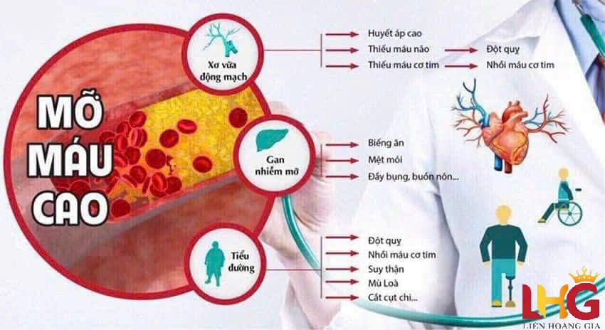 Viên uống Tinh Dầu Thông Đỏ Kwangdong giúp ổn định huyết áp và phòng ngừa đột quỵ